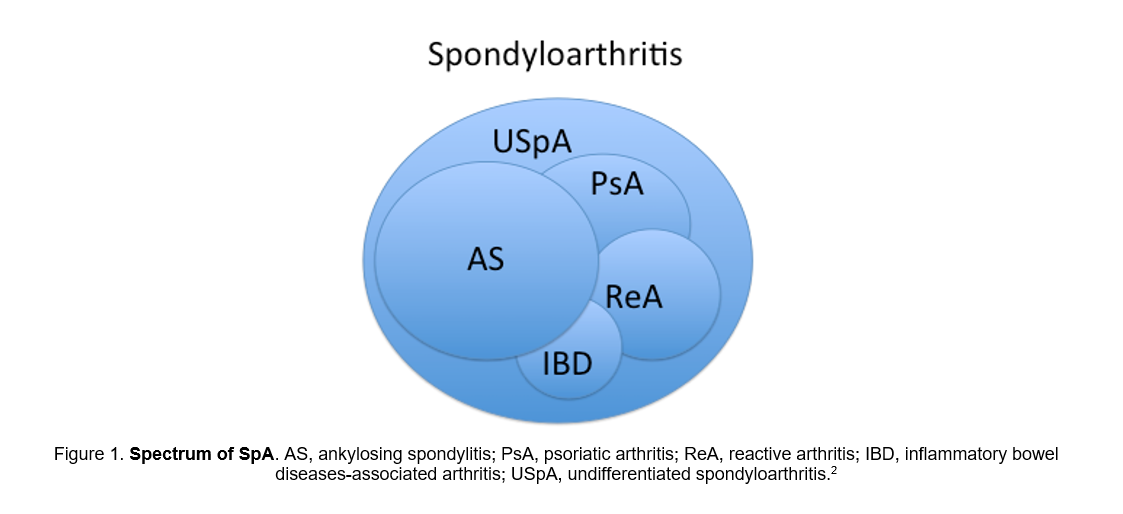 Spectrum of SpA